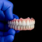 پروتز دندانی